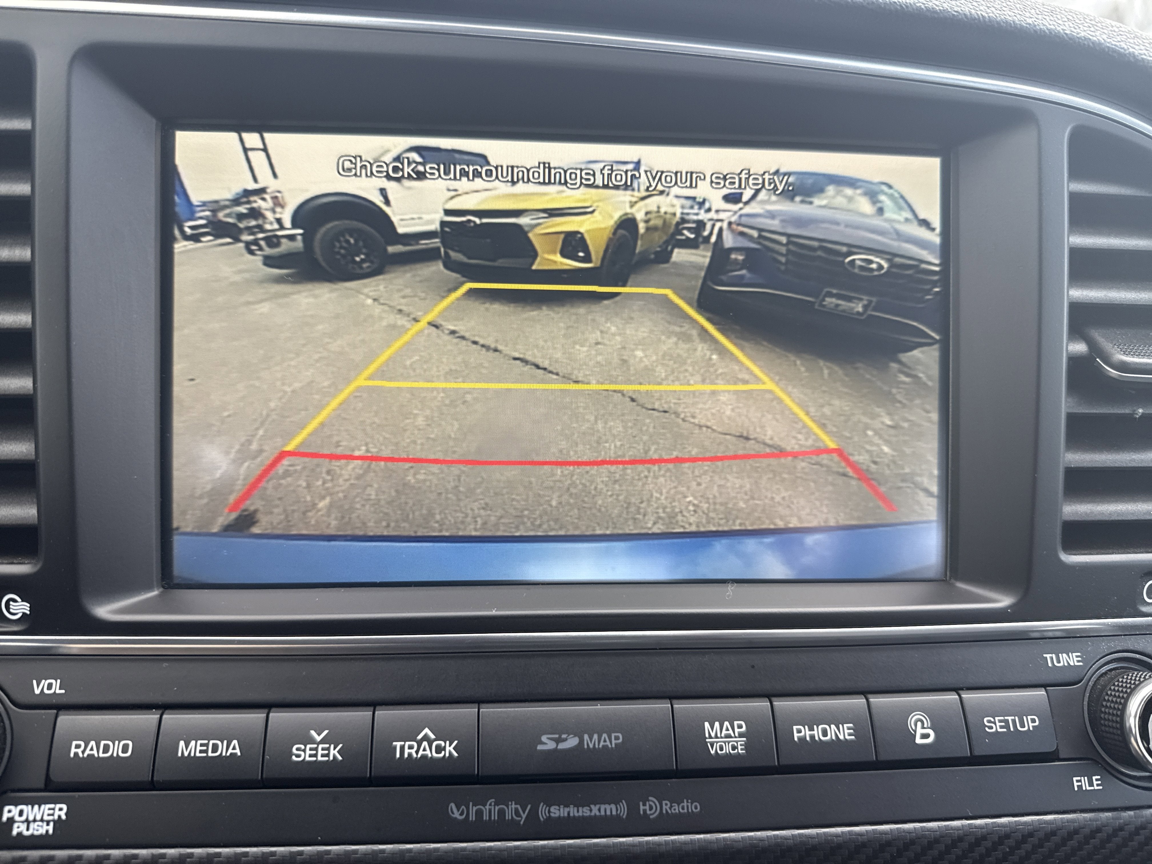 2017 Hyundai Elantra Sport